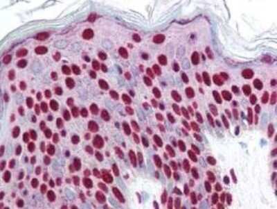 Immunohistochemistry: Smad3 [p Ser423, p Ser425] Antibody [NBP1-77836]
